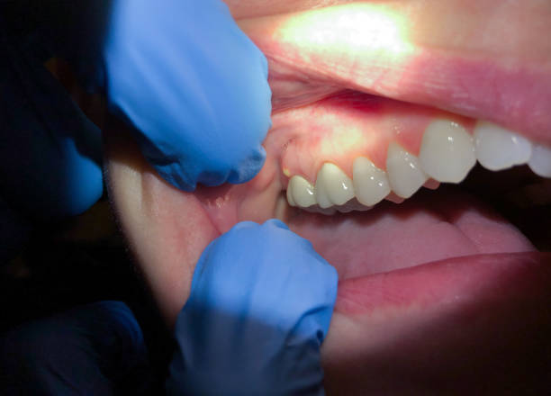 Best Walk-In Emergency Dentist in White City, FL