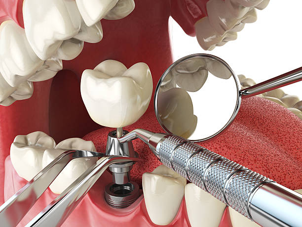 Best Walk-In Emergency Dentist in White City, FL