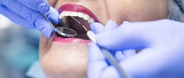 Best Emergency Tooth Extraction in White City, FL